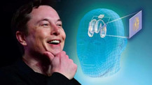 Elon Musk bunu da yaptı, beynine çip takılan insan zihin gücüyle oyun oynadı