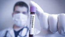 3. doz koronavirüs aşısı duyuruldu!