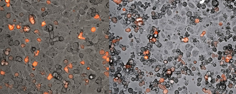 3 Türk bilim insanı kanserle savaşmak için hücre üretti - Resim : 1