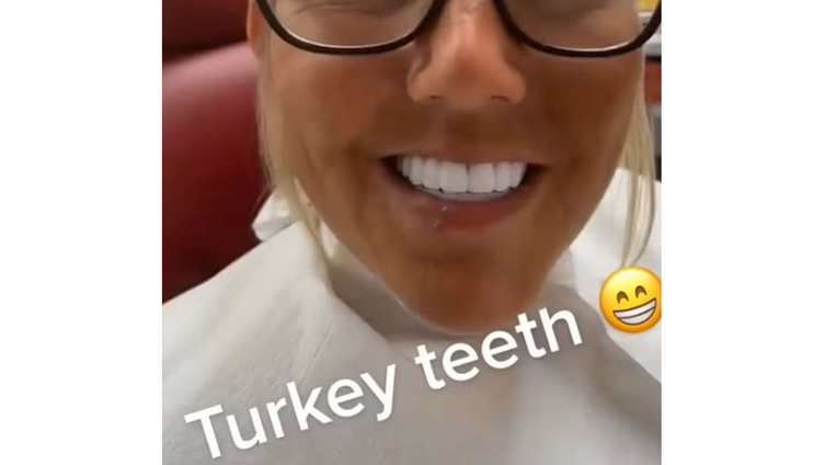 Türkiye'de diş tedavisi gördü! Sosyal medyada olay oldu - Resim : 1
