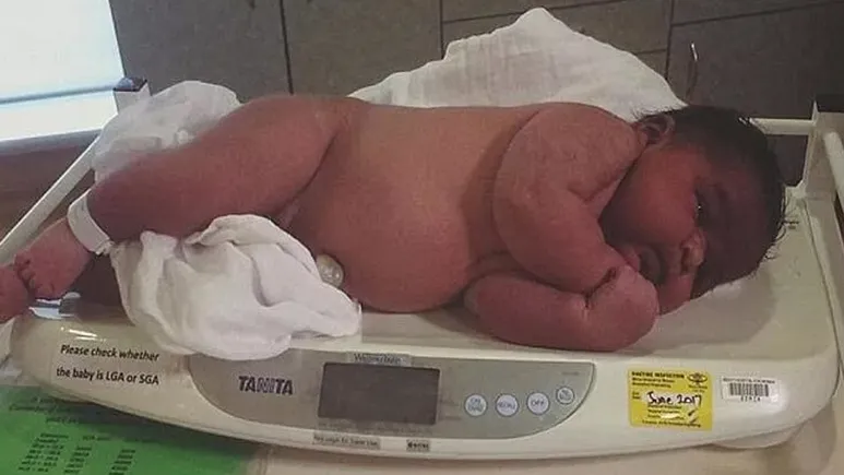 D�nyan�n en a��r bebe�i tarihe ge�ti! Kilosuyla herkesi �a��rtt�