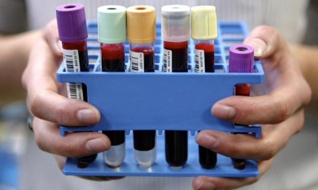 5 yıl içinde ölüm riskinizi hesaplayan sistem - Page 2