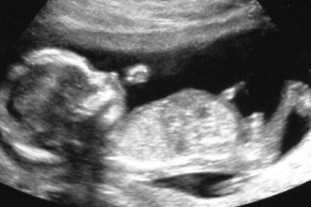İnsan derisini hücrelerini sperm ve yumurtaya çevirdiler - Page 2