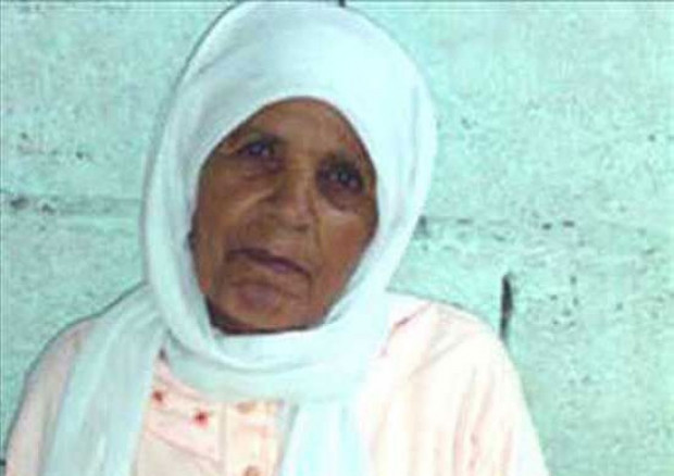 İşte dünya tıp tarihinde sebebi ve gizemi çözülememiş benzersiz vakalar - Page 4