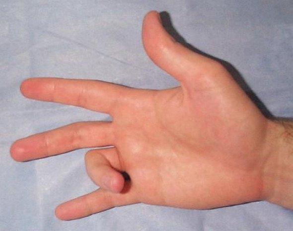 Parmak çıtlatma sesi nereden geliyor? - Page 4