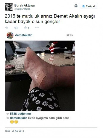 Sosyal medyada Demet Akalın'ın ayağına yapılan en komik 19 yorum - Page 2